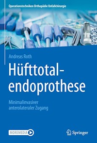 Hüfttotalendoprothese: minimalinvasiver anterolateraler Zugang - Andreas Roth - E-Book