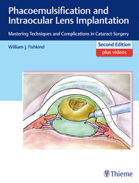Phacoemulsification and Intraocular Lens Implantation - William J. Fishkind - E-Book