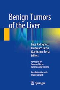 Benign Tumors of the Liver -  - E-Book