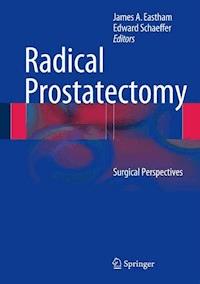 Radical Prostatectomy -  - E-Book