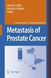 Metastasis of Prostate Cancer -  - E-Book