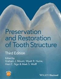Preservation and Restoration of Tooth Structure - - E-Book