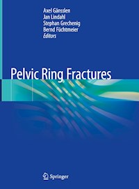 Pelvic Ring Fractures -  - E-Book