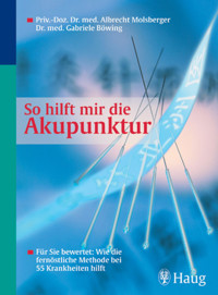 So hilft mir die Akupunktur - Albrecht Molsberger - E-Book