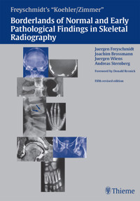 Freyschmidt's "Koehler/Zimmer" Borderlands of Normal and Early Pathological Findings in Skeletal Radiography - Jürgen Freyschmidt - E-Book