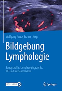 Bildgebung Lymphologie -  - E-Book