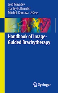 Handbook of Image-Guided Brachytherapy - - E-Book