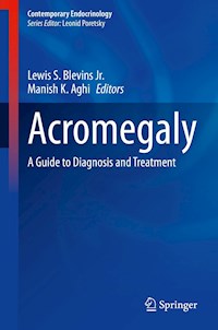 Acromegaly -  - E-Book