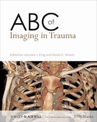 ABC of Imaging in Trauma -  - E-Book