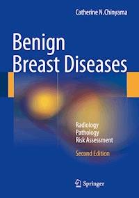 Benign Breast Diseases - Catherine N. Chinyama - E-Book