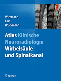 Atlas Klinische Neuroradiologie -  - E-Book