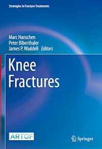Knee Fractures -  - E-Book