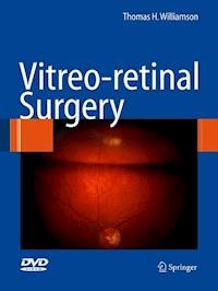 Vitreoretinal Surgery - Thomas H. Williamson - E-Book