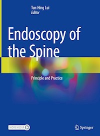 Endoscopy of the Spine -  - E-Book