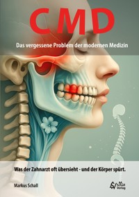 CMD - Das vergessene Problem der modernen Medizin - Markus Schall - E-Book