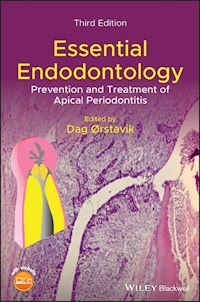 Essential Endodontology -  - E-Book