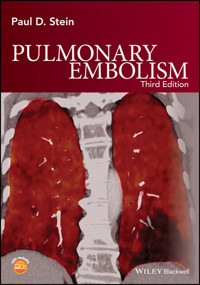Pulmonary Embolism - Paul D. Stein - E-Book