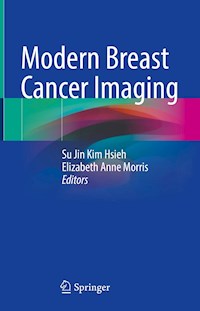 Modern Breast Cancer Imaging -  - E-Book