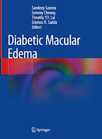 Diabetic Macular Edema -  - E-Book
