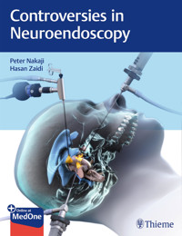Controversies in Neuroendoscopy - Peter Nakaji - E-Book