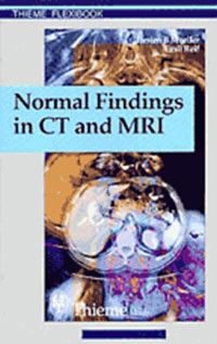 Normal Findings in CT and MRI - Torsten Bert Moeller - E-Book