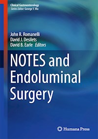 NOTES and Endoluminal Surgery -  - E-Book
