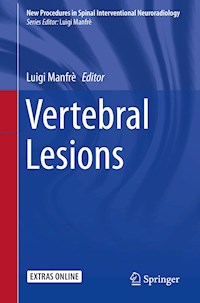 Vertebral Lesions -  - E-Book