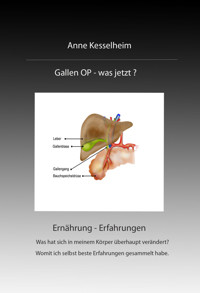 Gallen OP - was nun? - Anne Kesselheim - E-Book