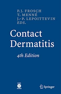 Contact Dermatitis -  - E-Book