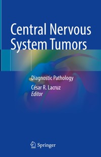 Central Nervous System Tumors - - E-Book