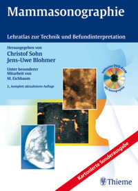Mammasonographie - Christof Sohn - E-Book