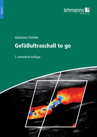 Gefäßultraschall to go - Johnnes Frömke - E-Book