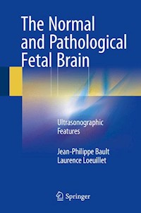 The Normal and Pathological Fetal Brain - Jean-Philippe Bault - E-Book