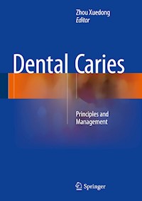 Dental Caries - - E-Book