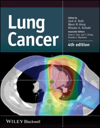 Lung Cancer -  - E-Book