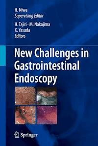 New Challenges in Gastrointestinal Endoscopy -  - E-Book