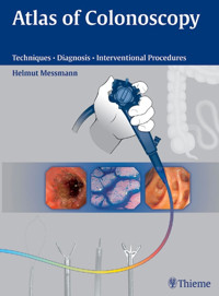 Atlas of Colonoscopy - Helmut Messmann - E-Book