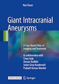 Giant Intracranial Aneurysms - Naci Kocer - E-Book