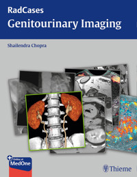 Radcases Genitourinary Imaging - Shailendra Chopra - E-Book