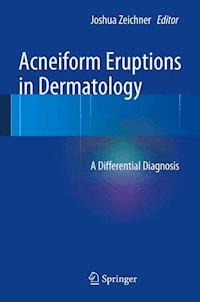 Acneiform Eruptions in Dermatology -  - E-Book