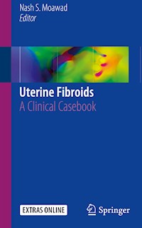 Uterine Fibroids -  - E-Book