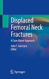 Displaced Femoral Neck Fractures -  - E-Book