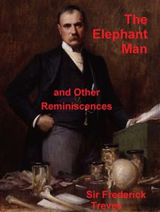 The Elephant Man and Other Reminiscences - Sir Frederick Treves - E-Book