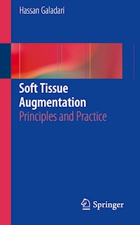 Soft Tissue Augmentation - Hassan Galadari - E-Book