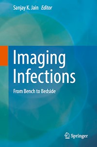 Imaging Infections -  - E-Book