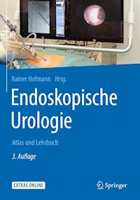 Endoskopische Urologie -  - E-Book