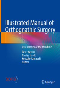 Illustrated Manual of Orthognathic Surgery -  - E-Book
