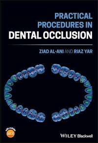 Practical Procedures in Dental Occlusion - Ziad Al-Ani - E-Book