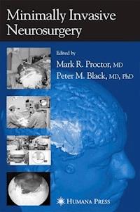 Minimally Invasive Neurosurgery -  - E-Book