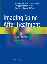 Imaging Spine After Treatment -  - E-Book